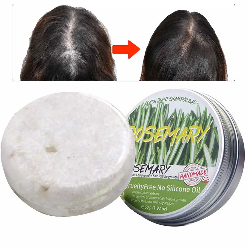 Шампунь с розмарином| Мыло для восстановления поврежденных волос, Сыворотка для предотвращения выпадения волос, раствор для кожи головы для мужчин и женщин . ' - ' . 3